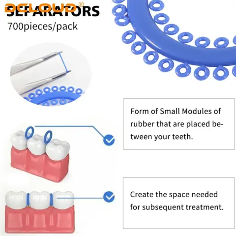 Orthodontic Elastic Separators, S Type · Image 2